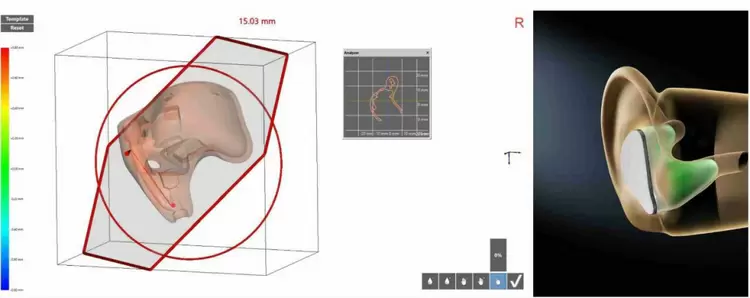 近四成人佩戴耳机超5小时! 超长时间佩戴成为刚需,定制蓝牙耳机成为唯一解(图5) 近四成人佩戴耳机超5小时! 超长时间佩戴成为刚需,定制蓝牙耳机成为唯一解(图5)