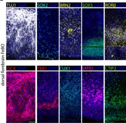 华夏源类器官：大脑类器官新突破！《Cell》：首次从人胎大脑组织衍生类器官！(图5)