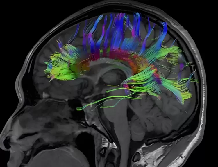 重磅发布丨深视智能全新背照式制冷sCMOS相机新品上市，突破灵敏度和噪声极限(图5)