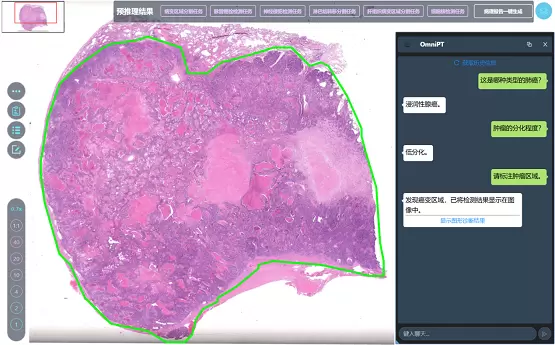 浙江大学发布人机交互AI病理诊断大模型OmniPT，推动数字病理智能化临床应用(图2)