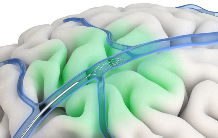 陈天桥抢先押注，脑机接口公司成功首秀苹果(图3)